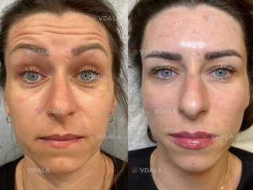 Косметолог Ботокс - VDALA.PRO