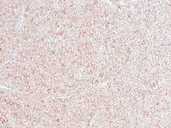 Рідкі шпалери термостійкі - 1 Рідкі шпалери термостійкі - VDALA.PRO - 1